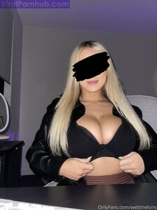 WettMelons Hot Onlyfans leaks photo 92