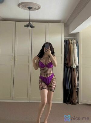 Acnoctem Nude Photos photo 106