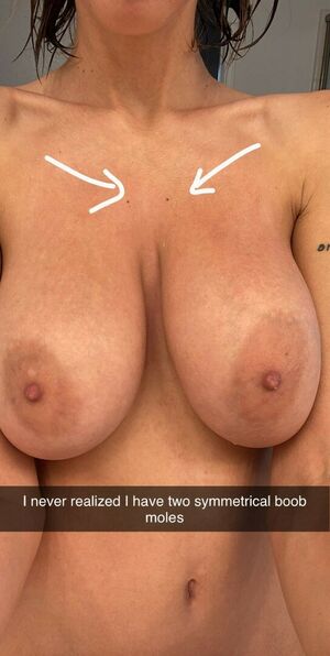 Hopelesssofrantic Nude Photos photo 43